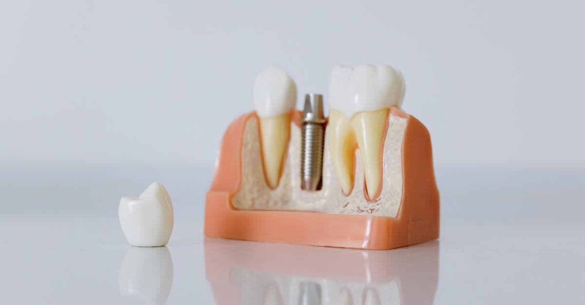Cover image for Unlocking the Secrets of Dental Surgery: A Comprehensive Guide