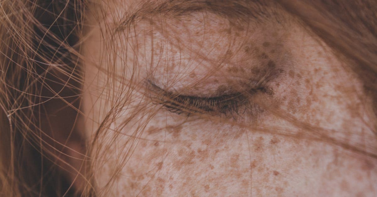 Cover image for Transform Your Look: The Ultimate Guide to Eyelid Surgery