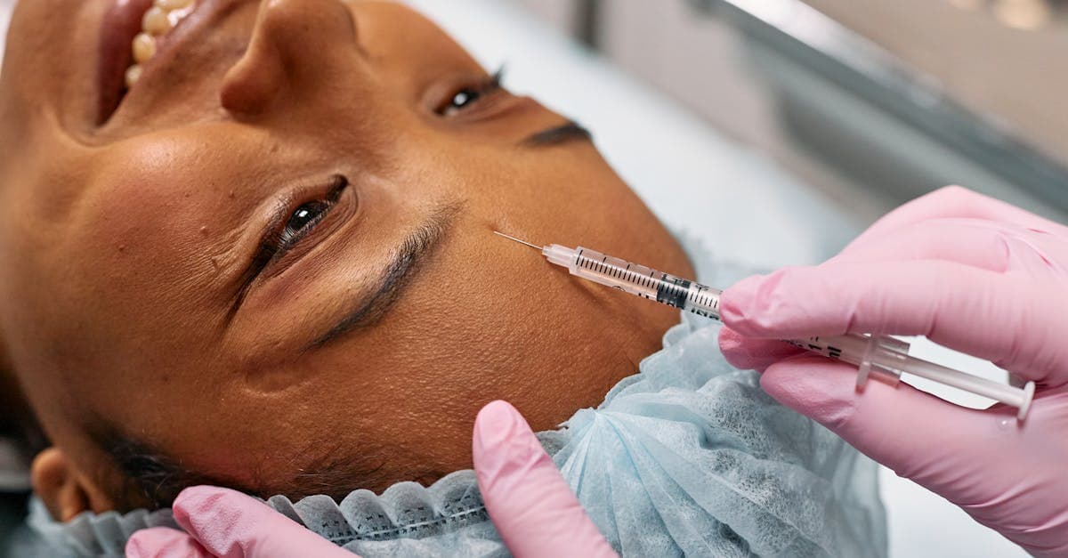 Cover image for Revitalize Your Look: The Ultimate Guide to Dermal Face Fillers