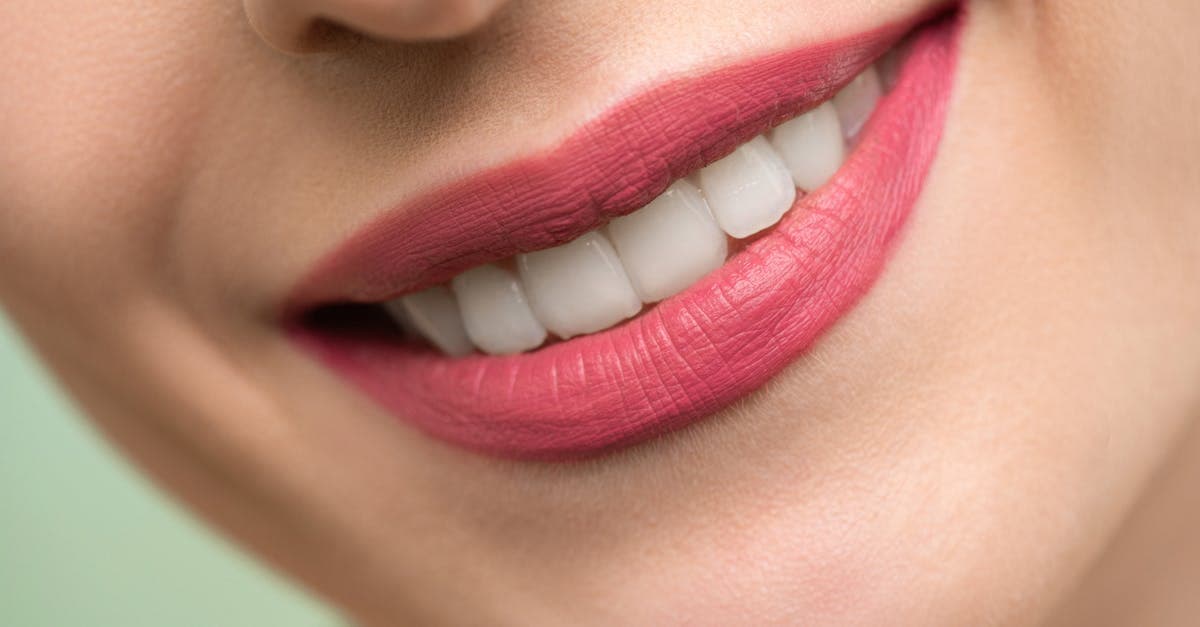 Cover image for Understanding Overbite and Gap Teeth: Solutions for a Healthier Smile