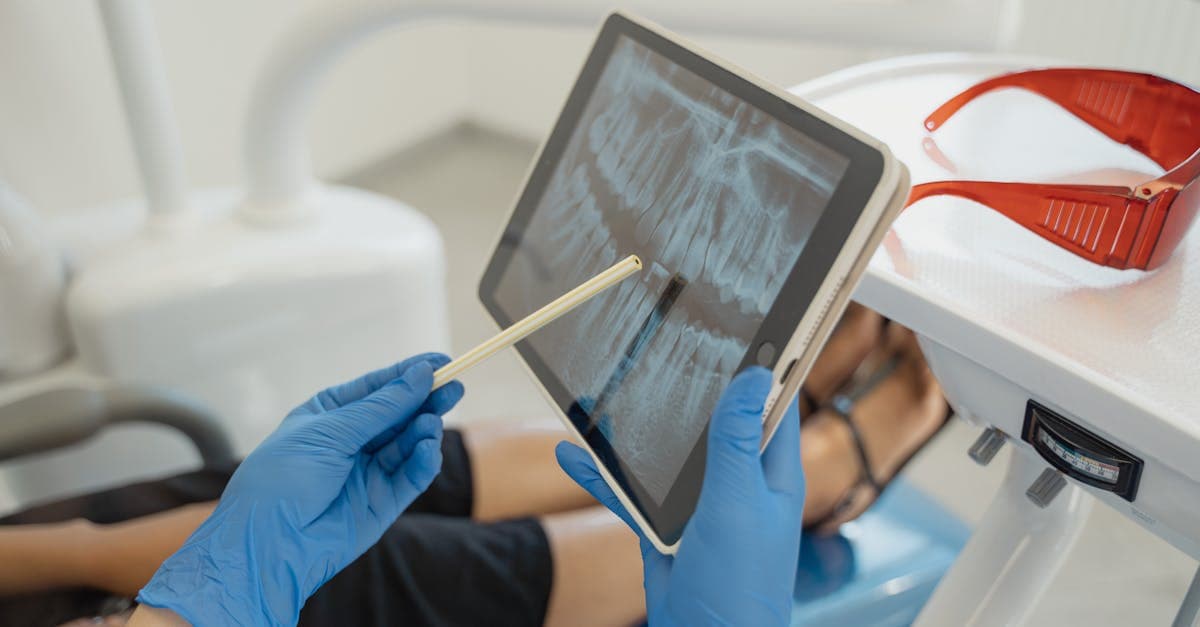 Cover image for Unraveling Root Canals: Your Essential Guide to Pain-Free Smiles