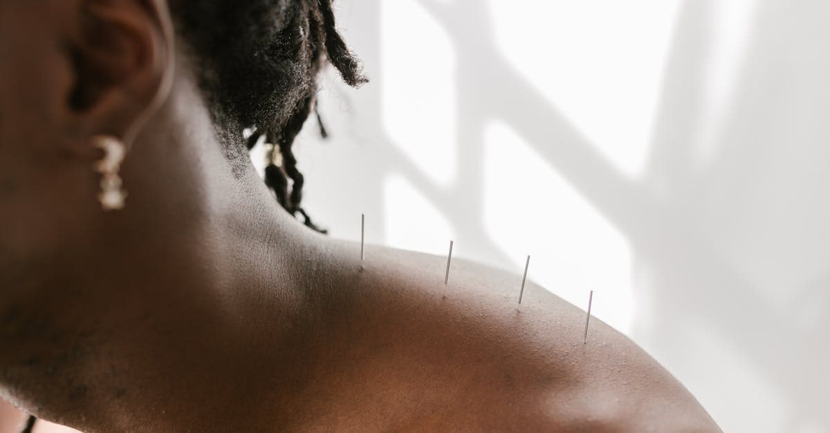 Cover image for Revolutionary Approaches to Shoulder Pain Relief: Your Ultimate Guide